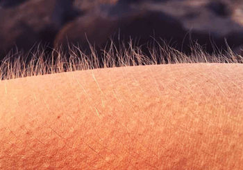 Wenn du von Musik Gänsehaut bekommst